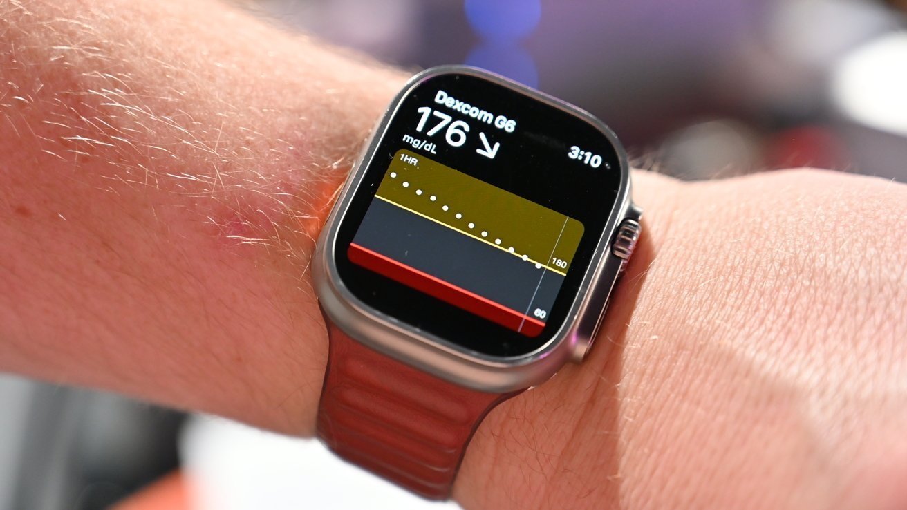 Apple Watch 13 kan måle blodsukker fra 2027